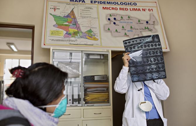 A doctor examines an X-ray of Tamara’s lungs. Shortly after getting on HIV medication, Tamara was diagnosed with Tuberculosis. A doctor examines an X-ray of Tamara’s lungs. Shortly after getting on HIV medication, Tamara was diagnosed with Tuberculosis.