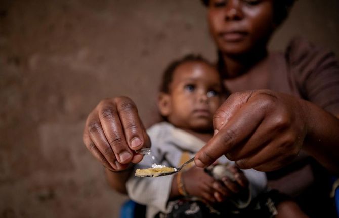Kansiime gives her one-year-old daughter her paediatric HIV medicine at home in western Uganda. Photo: UNICEF/UNI211882/Schermbrucker Kansiime gives her one-year-old daughter her paediatric HIV medicine at home in western Uganda. Photo: UNICEF/UNI211882/Schermbrucker